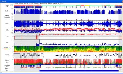on reparle des troubles du sommeil